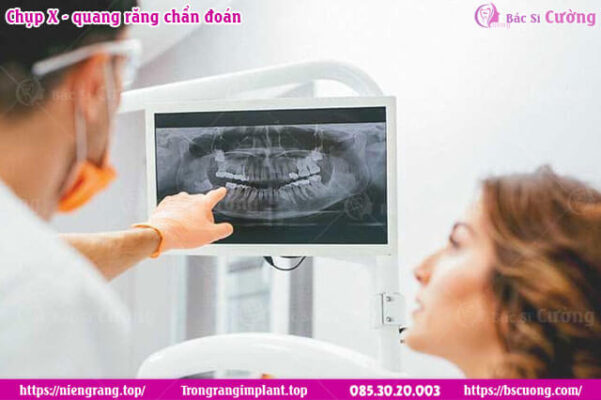 chup-x-quang-rang-chan-doan-va-dieu-tri-nieng-rang-nho-rang-trong-rang-bac-si-cuong